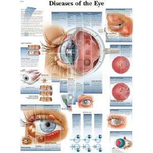  Diseases of the Eye Chart Industrial & Scientific