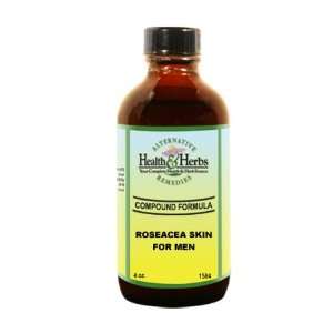  Alternative Health & Herbs Remedies Rosacea Skin Formula 